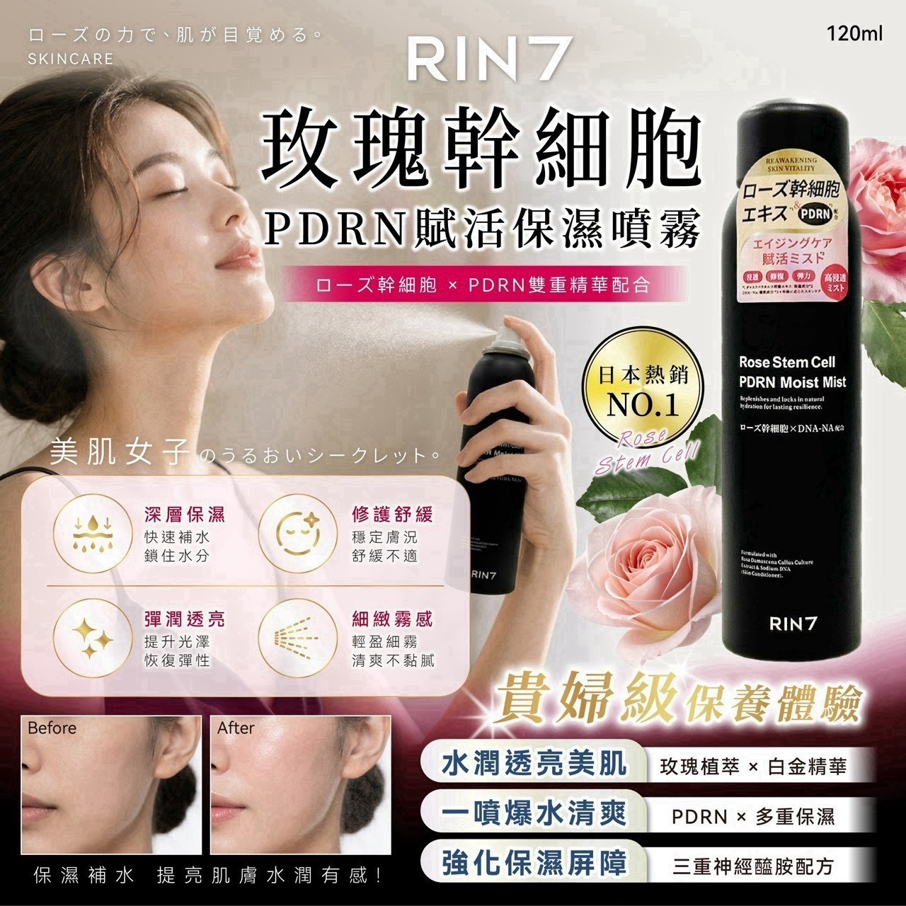 預購-08/31免48▲前上-RIN7玫瑰幹細胞PDRN賦活保濕噴霧120ml