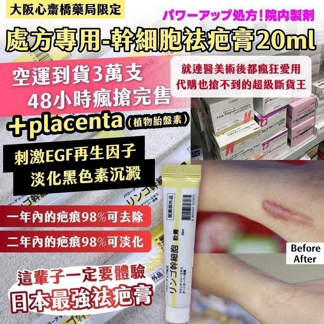 預購-11/9免100▲P-AN025⏰-|💊大阪心齋橋藥局限定|處方專用-幹細胞祛疤膏20ml
